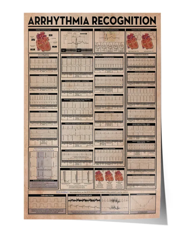 Arrhythmia Recognition Knowledge Wall Decor Artwork Print Poster Wall Art Print Home Decor Vintage